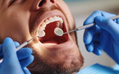 Tooth Extraction in Indore: When Is It Necessary and What to Expect?